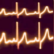 Monitor the Pulse of Your Website
